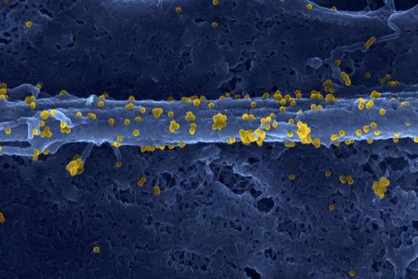 Fibroblaste, cellule présente dans le tissu conjonctif