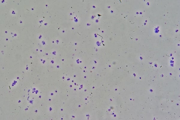 Toxoplasma gondii