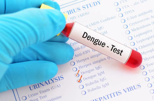 Cas de dengue en France : que faut-il savoir ?